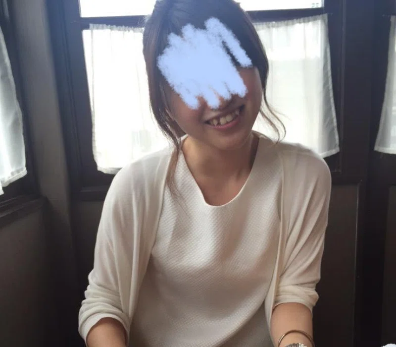 歯列矯正で変わる顔の印象 みみみ Note