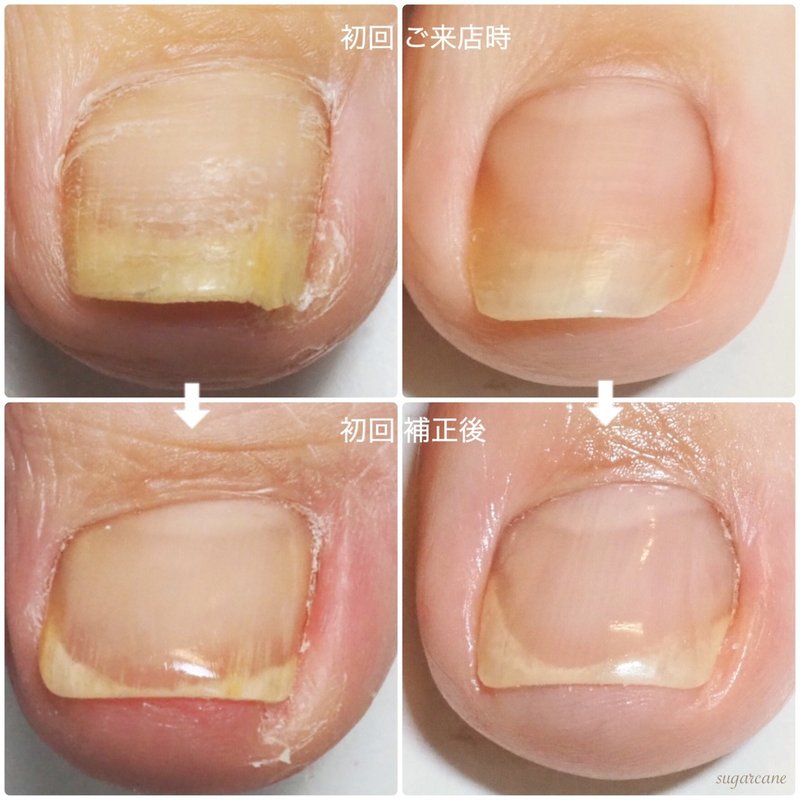 ご自身の爪は今どんな形をしていますか Nailsalon Sugarcane Note
