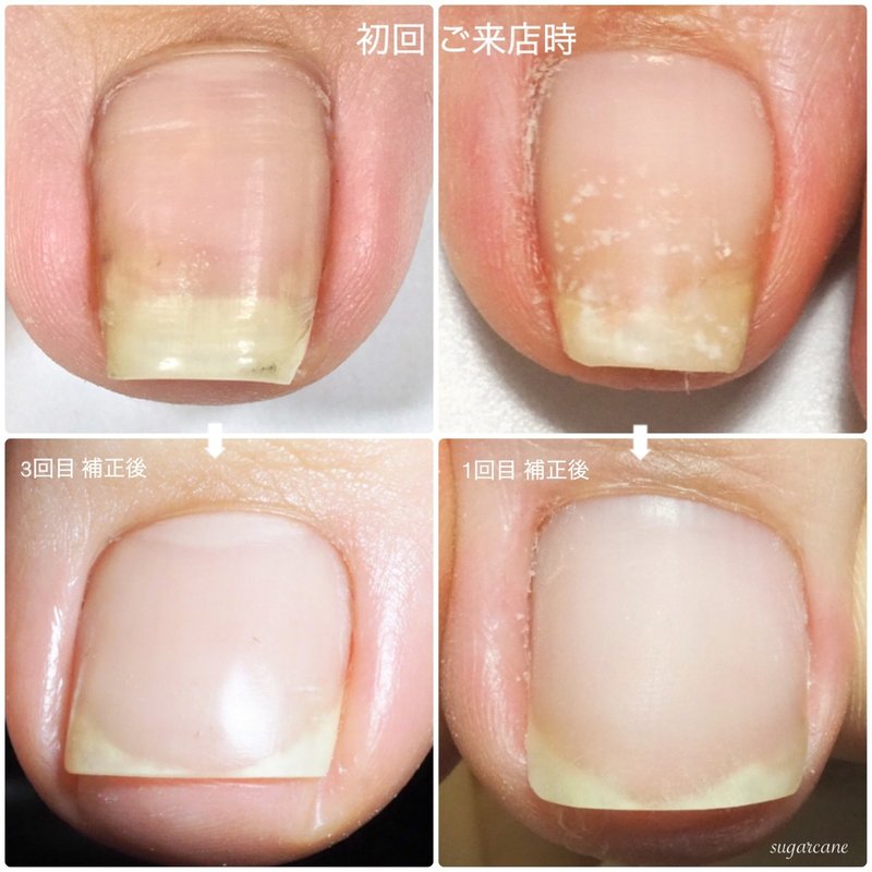 ご自身の爪は今どんな形をしていますか Nailsalon Sugarcane Note