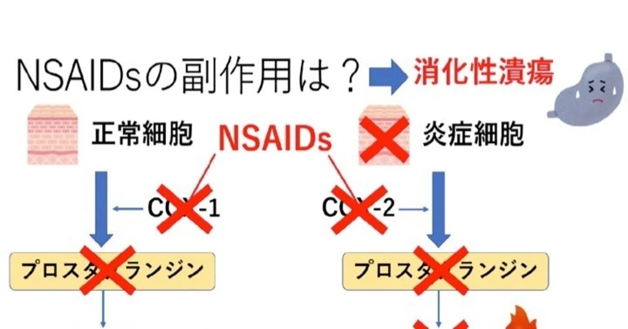 バ ァリンの半分はやさしさでできている?〜NSAIDsの特徴と副作用〜|のうと医療専門学校