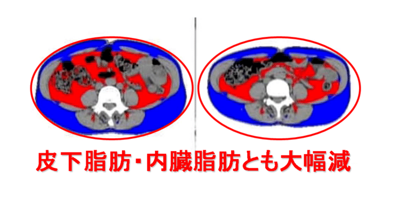 ダイエットは、もう終わった