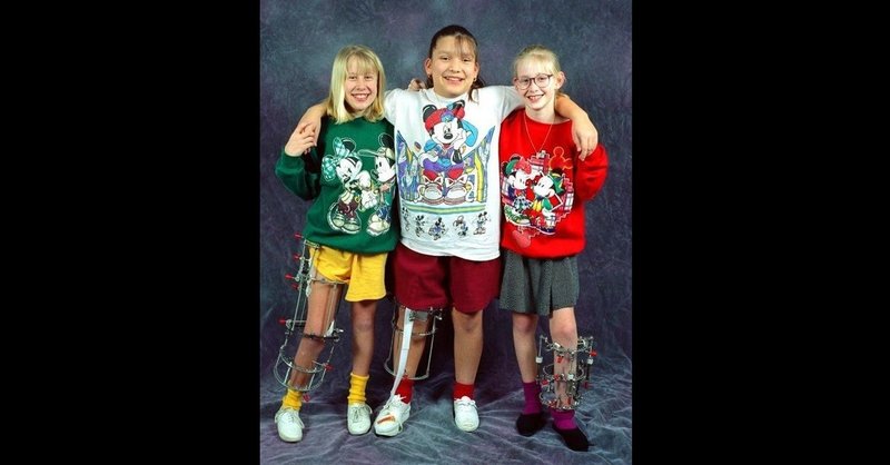 無料 イリザロフ手術ってナニさ gen 身長をカネで買った医者 note