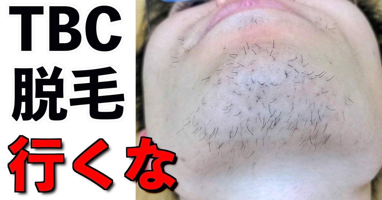 Tbcスーパーヒゲ脱毛はオススメしない よっぴさん 簿記教育を身近にする人 Note
