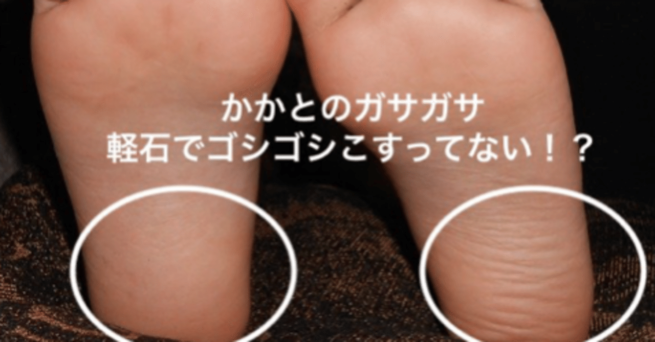 かかとのガサガサ 軽石でこすってない 高齢者を足から笑顔に 中西薫 Note