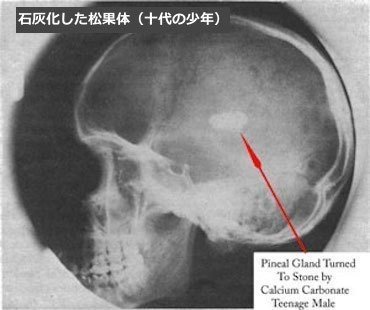 危険 松果体を活性化させる方法には要注意ッ 青春エイリアンズ商店39番地 開店準備中 Note 危険 松果体を活性化させる方法には要注意ッ 青春エイリアンズ商店39番地 開店準備中 Note