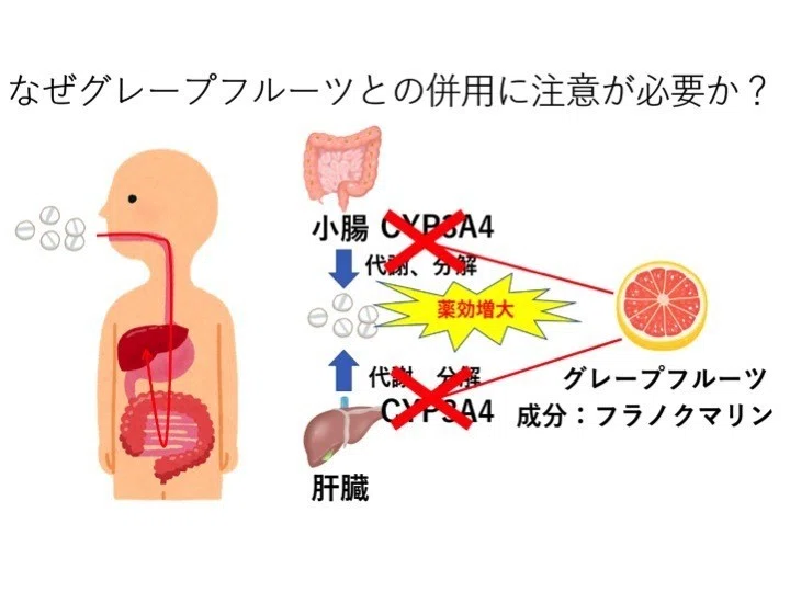 問題です グレープフルーツと併用注意の薬は次のうちどれ 1 利尿薬 2 カルシウム拮抗薬 3 Ace阻害薬 のうと医療専門学校 Note