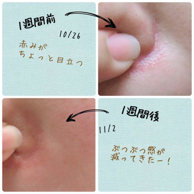 Kooで1週間夜だけ美容断食生活してました すもも Note