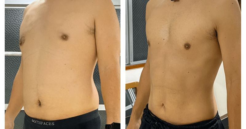3ヶ月で 20kgの過激なダイエットに成功した私 金まさがリバウンドしない理由 金まさ 趣味はダイエット 特技はリバウンド Note