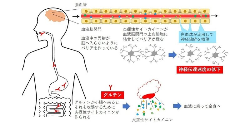 グルテンによる神経症状