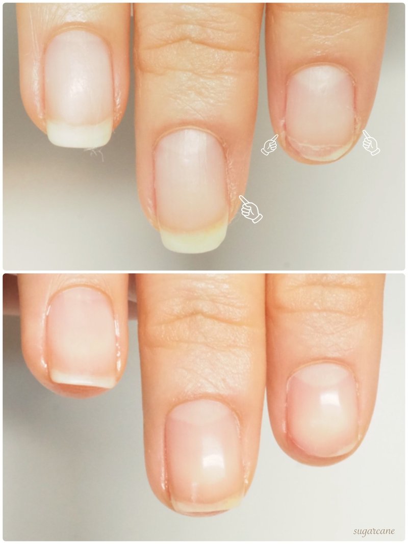 2枚爪やささくれが出来難くするにはどうしたら良いですか Nailsalon Sugarcane Note 2枚爪やささくれが出来難くするにはどうしたら良いですか Nailsalon Sugarcane Note