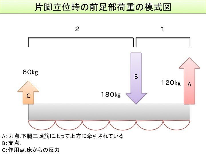 片脚立位時の前足部の模式図（例）