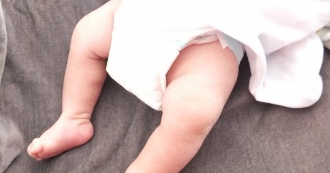 赤ちゃんが数日うんちをしていない 赤ちゃんのうんちの回数が減る理由と便秘の見分け方 Kulo Note 赤ちゃんが数日うんちをしていない 赤ちゃんのうんちの回数が減る理由と便秘の見分け方 Kulo Note