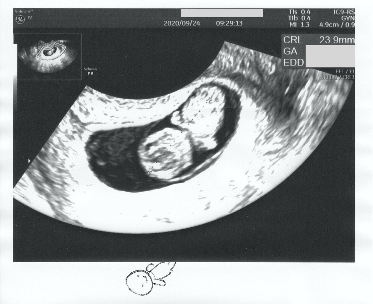 9週の壁 が怖かった 妊娠7w 9w日記 Akatsuki174 Note 9週の壁 が怖かった 妊娠7w 9w日記 Akatsuki174 Note