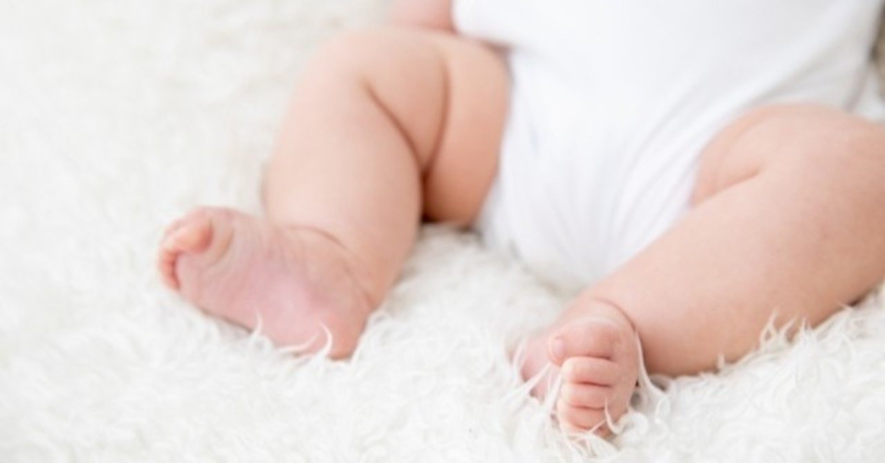 先天性股関節脱臼 発育性股関節形成不全 とは ファミリハつくば Note 先天性股関節脱臼 発育性股関節形成不全 とは ファミリハつくば Note