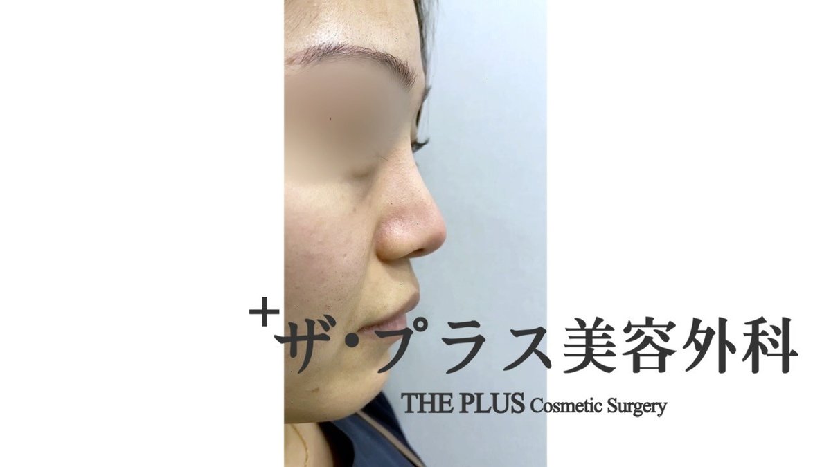 建築と鼻の手術｜ザ・プラス美容外科 東京代官山, image size:1200x675