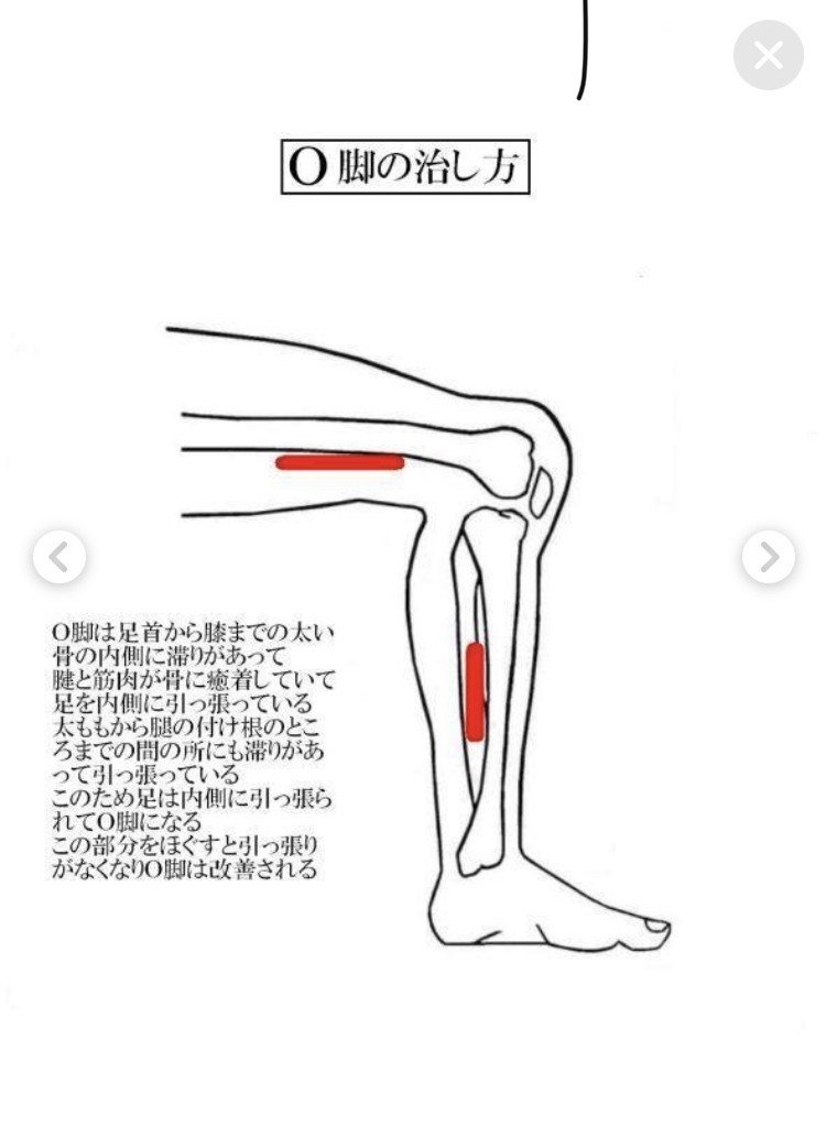 O脚も天城流湯治法で楽にします💓｜竹元泰子（膝楽院）