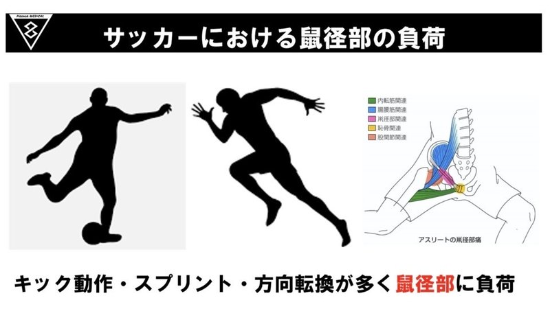 サッカー選手のGroin pain競技復帰に向けてのメディカルリハビリテーション.003