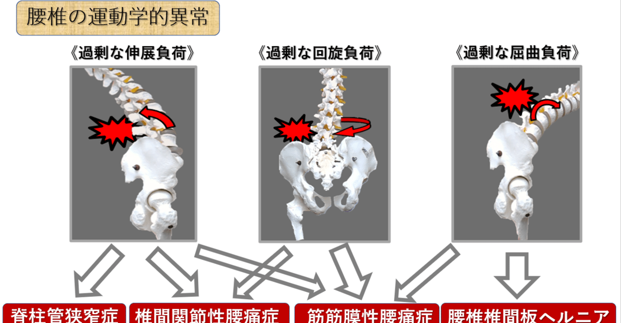 腰部・骨盤帯 第2回 《運動学的異常 前編》｜上田浩司（理学療法士）