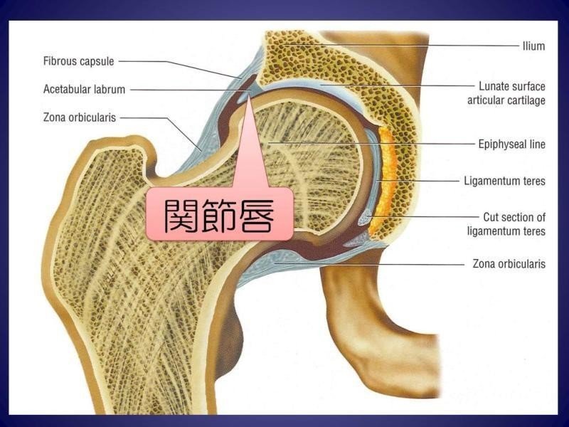 関節唇