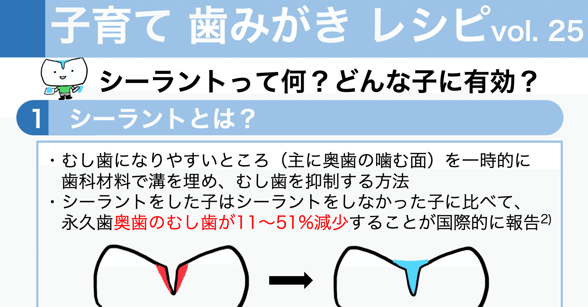 シーラントって何 どんな子に有効 子育て歯みがきレシピ Vol 25 子育て歯みがきレシピ Note