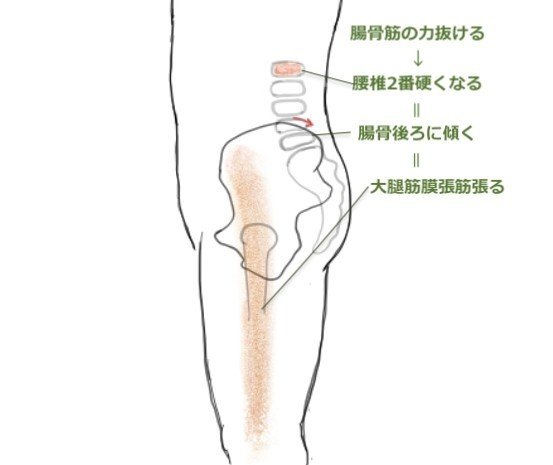 2020.9.18.腰椎2番／大腿筋膜張筋／腸骨後傾②