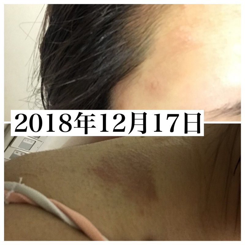 講座 肌がキレイになる 美肌思考 青木 ラン Note 講座 肌がキレイになる 美肌思考 青木 ラン Note