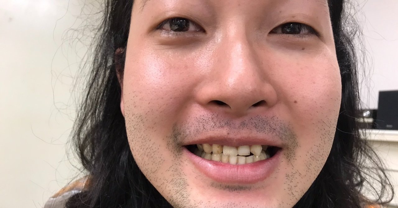 かが屋の鶴の間 ４６ 放送後記 マウスピースつけたほうがいいですよ かが屋の鶴の間 Rccラジオ Note
