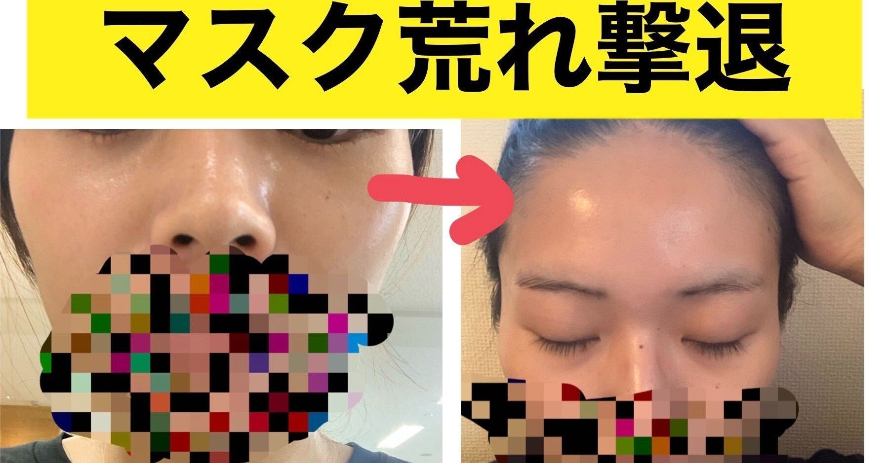 マスクで肌荒れ からの美肌へ 会社のnoteですっぴんをさらす女 文響社 Note