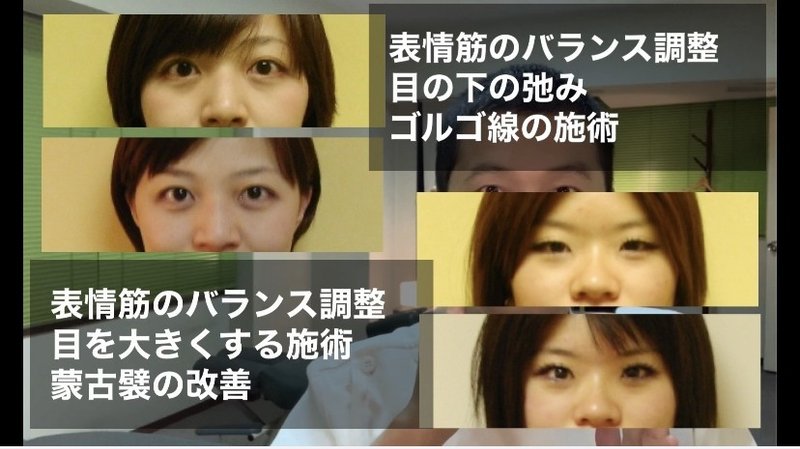 目の横幅を広げる方法 目を大きくする体操とマッサージ方法 お顔の整体師 戸塚哲春 Note 目の横幅を広げる方法 目を大きくする体操とマッサージ方法 お顔の整体師 戸塚哲春 Note