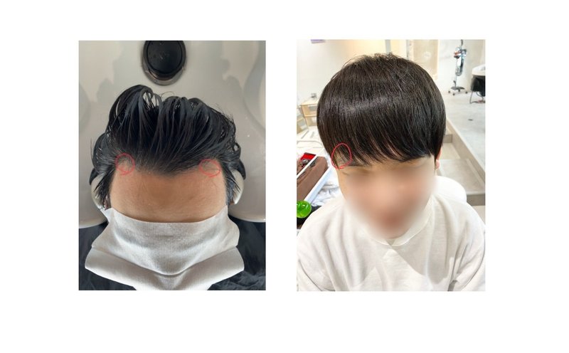 男性のお悩み おでこの広さ をカバーする髪型とは Yaw Yoichi 西村陽一 美容師 Note