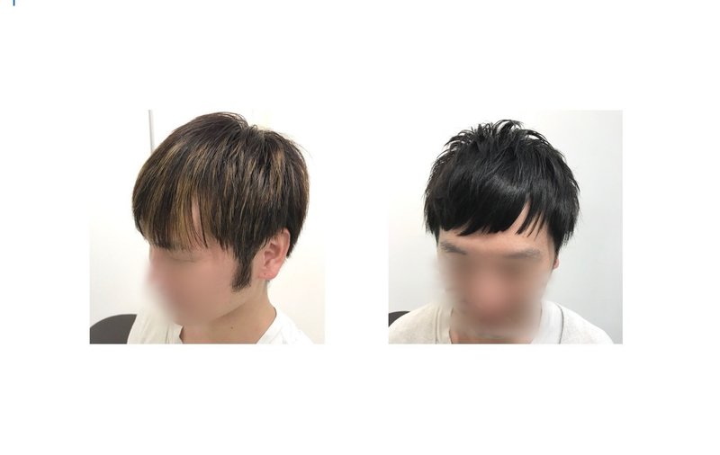 男性のお悩み おでこの広さ をカバーする髪型とは Yaw Yoichi 西村陽一 美容師 Note