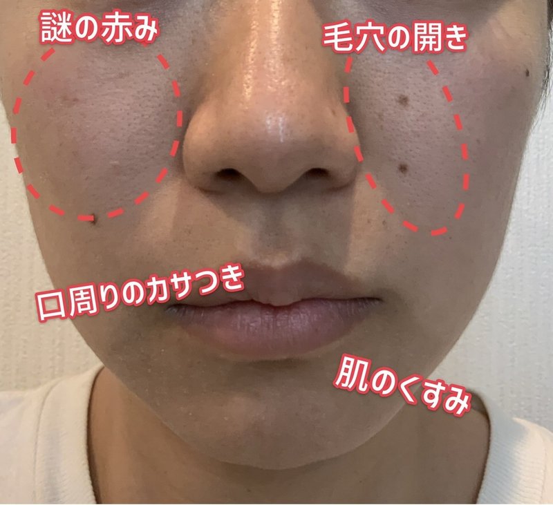 ゼオスキン体験談 1 ゼオスキンお試し隊 Note