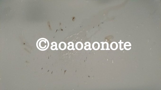 口内洗浄のプロポリンスは怪しい １ヶ月使ってみたので効果をレビューする 閲覧注意 蒼 なんでもライター Note