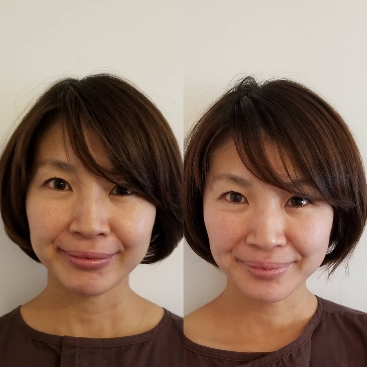 美容鍼灸before After 次の日もお肌ツルツルでした 未来に夢を描けるからだを作る 出張鍼灸師kimmiの はりきゅうこころ間