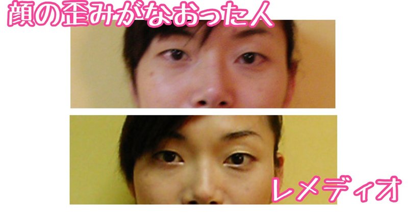 眉の高さが左右違うなおす方法 マッサージと体操のやり方 お顔の整体師 戸塚哲春 Note
