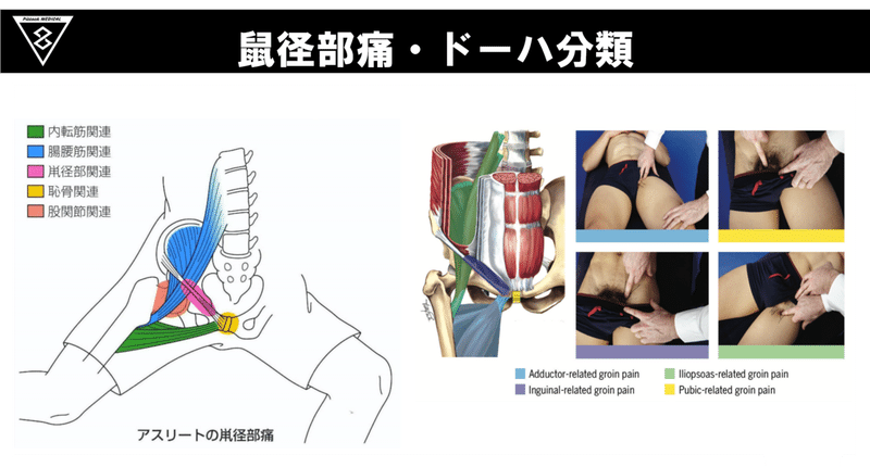 グローインペインで苦しまないために アスレティックリハビリ Pittockroom Medical Note グローインペインで苦しまないために アスレティックリハビリ Pittockroom Medical Note