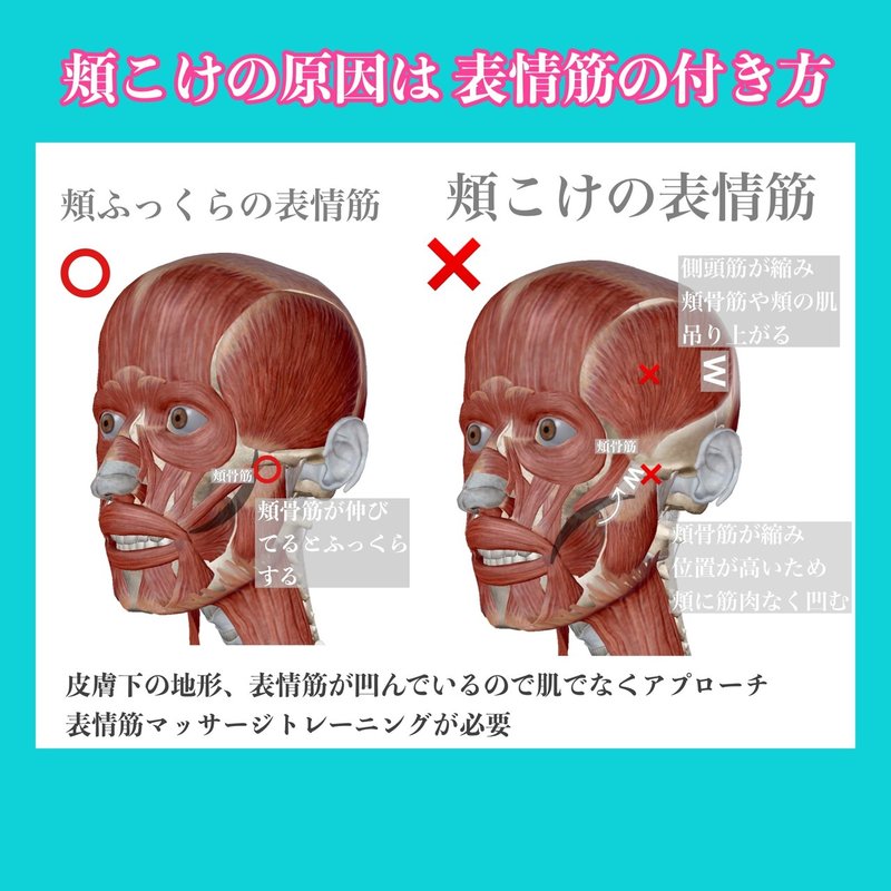 頬こけ原因となおし方 表情筋の体質改善とトレーニング方法 お顔の整体師 戸塚哲春 Note