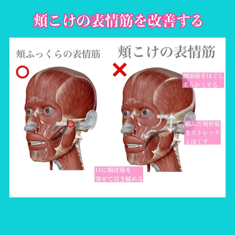 頬こけ原因となおし方 表情筋の体質改善とトレーニング方法 お顔の整体師 戸塚哲春 Note