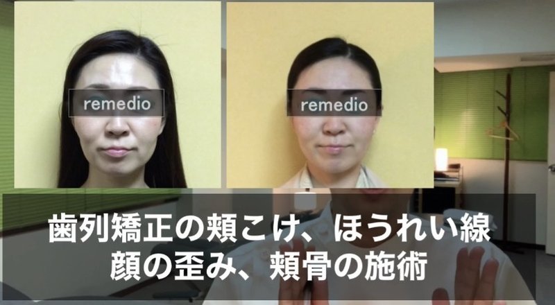 頬こけ原因となおし方 表情筋の体質改善とトレーニング方法 お顔の整体師 戸塚哲春 Note 頬こけ原因となおし方 表情筋の体質改善とトレーニング方法 お顔の整体師 戸塚哲春 Note