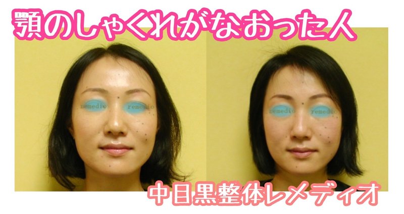 顎のしゃくれをなおす方法 姿勢改善とオトガイ筋マッサージ お顔の整体師 戸塚哲春 Note