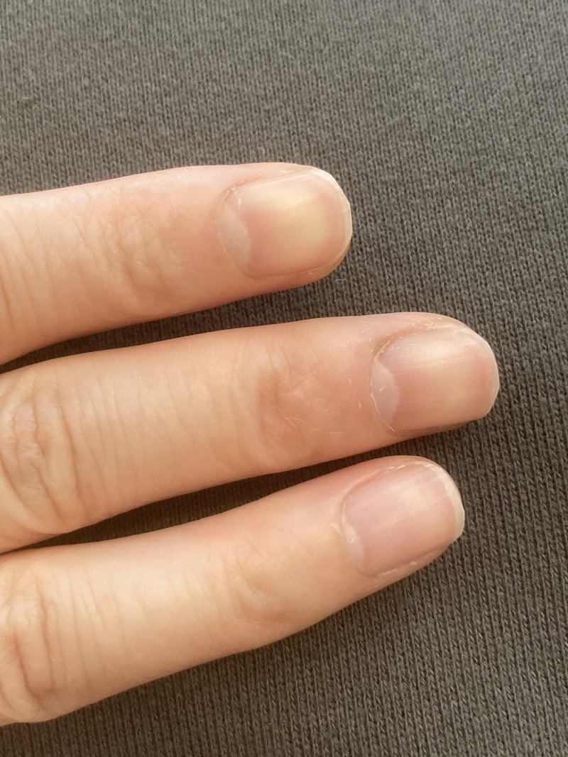 爪のタンパク質の構造について Snownail Note 爪のタンパク質の構造について Snownail Note