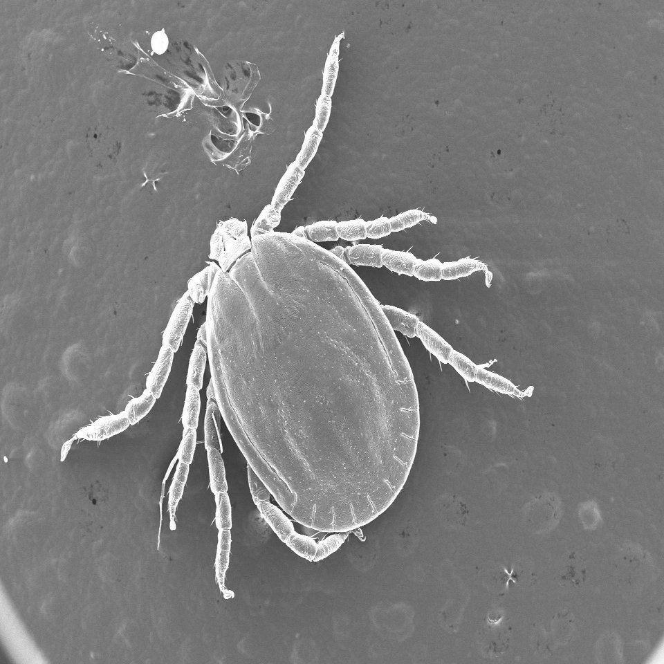 くっつく生き物 の くっつく構造 を電子顕微鏡でみてみよう 浜松科学館 みらいーら