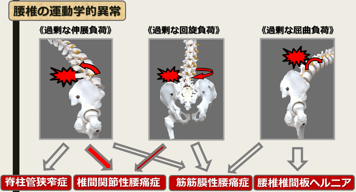 【おまとめ割引あり】分析からアジャストまで腰痛マスター【腰椎骨盤編】 股関節と骨盤意識で、腰痛、膝痛、肩こりとオサラバ: 理学療法士