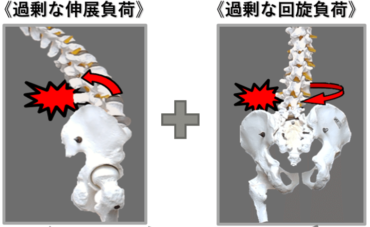 分析からアジャストまで腰痛マスター【腰椎編】
