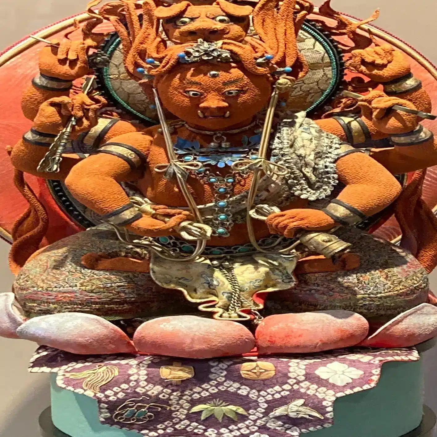 kaysen