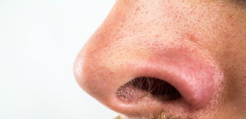 男性に多い毛穴の黒ずみの原因は 男性特有の にあった 男性スキンケアブランドrogen ロージェン Note