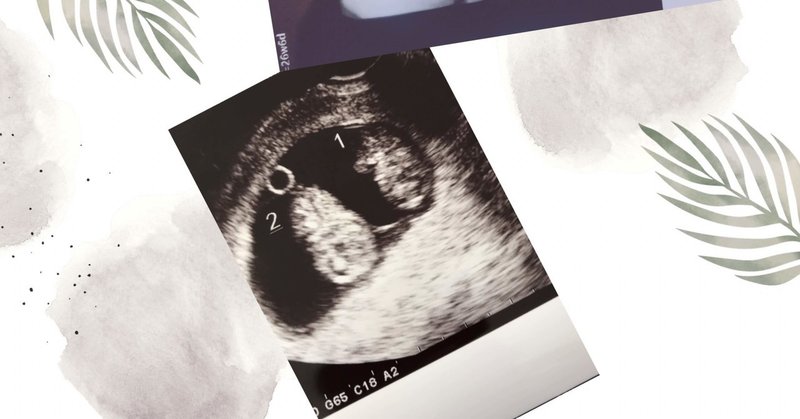 双子妊娠を告げられるとき 興奮と衝撃 楽しみ そして不安 My Life With Little Twin Girls Note