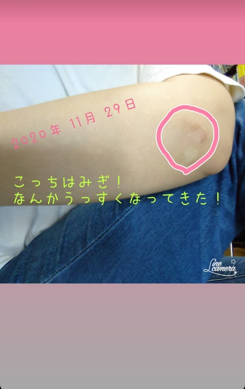 リングフィットアドベンチャー備忘録 肘がたいへん編 りょか Note リングフィットアドベンチャー備忘録 肘がたいへん編 りょか Note