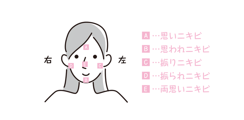 マスクのせいか お酒のせいか 思われニキビが止まらないあなたに 中目黒土産店 Note マスクのせいか お酒のせいか 思われニキビが止まらないあなたに 中目黒土産店 Note