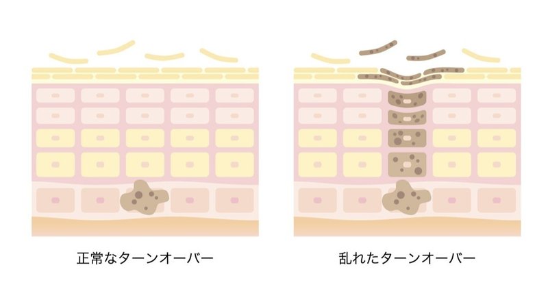 肌断食 は ニキビ 毛穴に効果的 メカニズムと正しいやり方 はだみ Note 肌断食 は ニキビ 毛穴に効果的 メカニズムと正しいやり方 はだみ Note